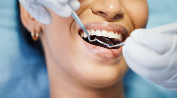 Best Emergency Root Canal Treatment in South Rosemary, NC