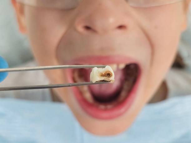 Best Emergency Dental Care for Trauma or Injury in South Rosemary, NC