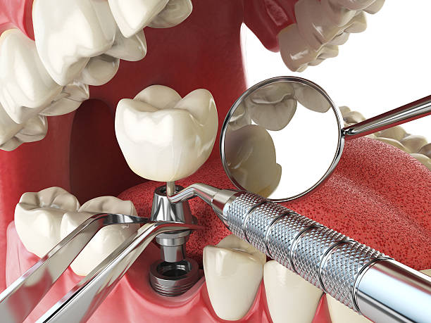 Best Walk-In Emergency Dentist in South Rosemary, NC