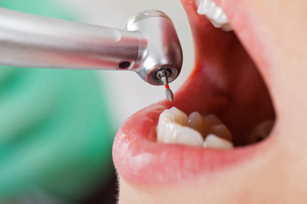 Best Same-Day Emergency Dentist in South Rosemary, NC